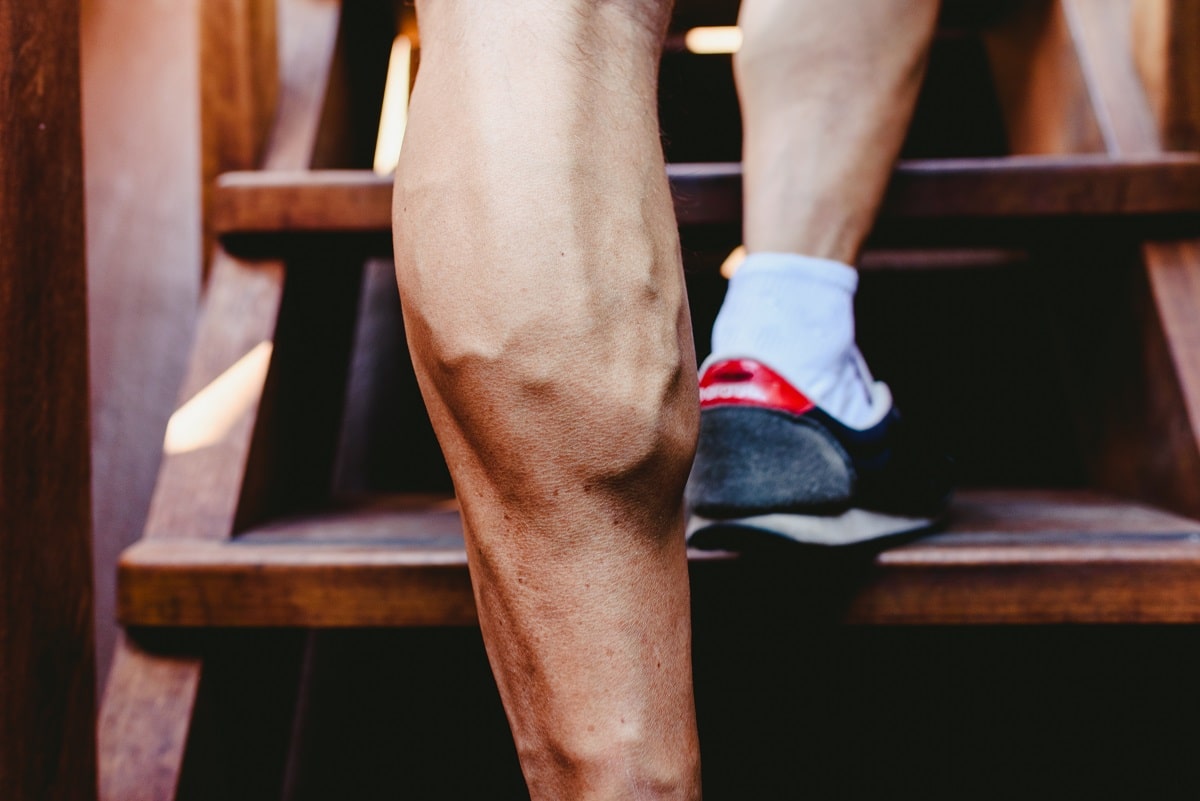Top Treatment Tips For Men With Varicose Veins