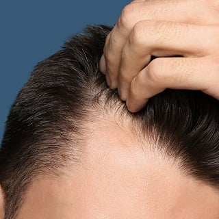 4 Simple Ways to Restore Hair Loss