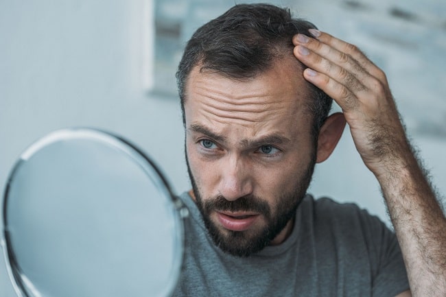Taking Hair Loss Into Your Own Hands