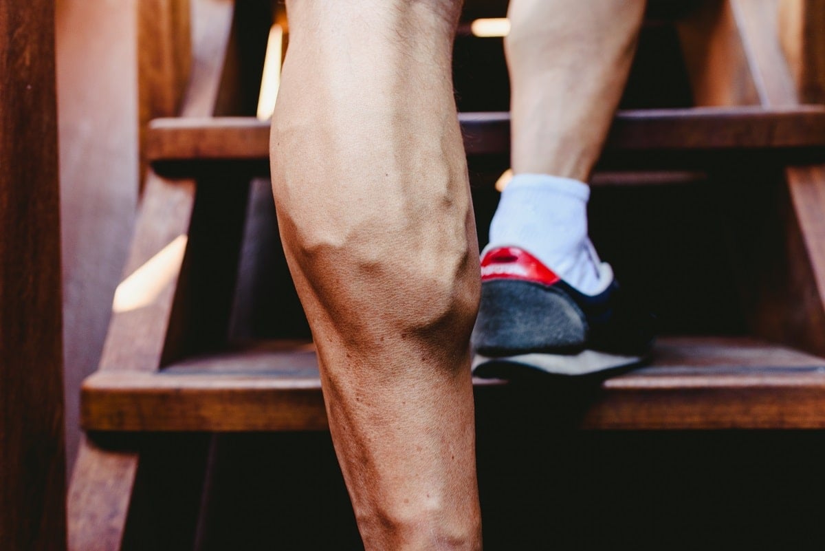 Top Treatment Tips For Men With Varicose Veins