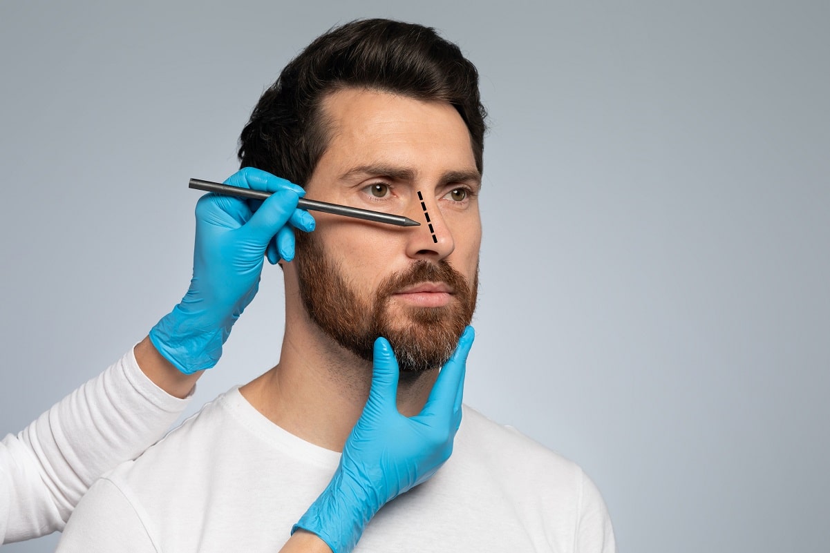 Nose Surgery for Men - Why It's Worth It