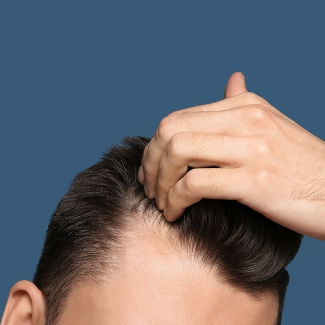 4 Simple Ways to Restore Hair Loss